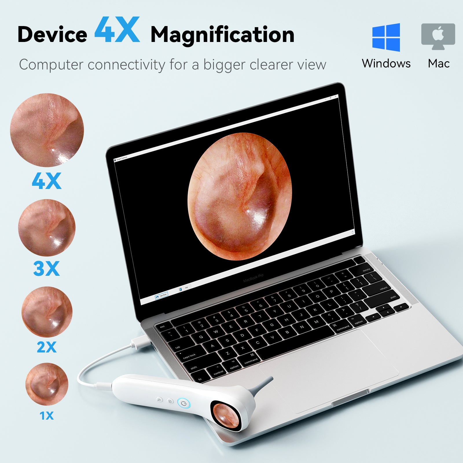 Smart Ear Wax Removal Tool With Camera & Display Screen