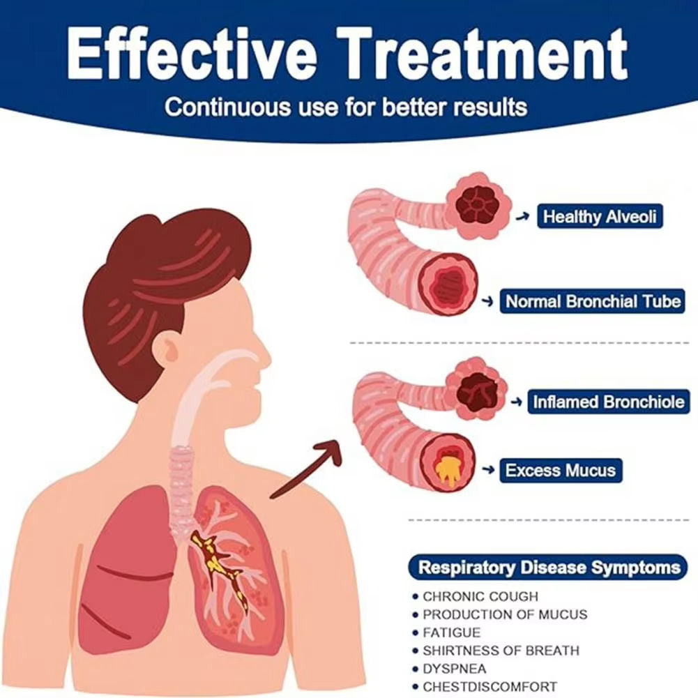 Rehabilitation Breathing Trainer Device